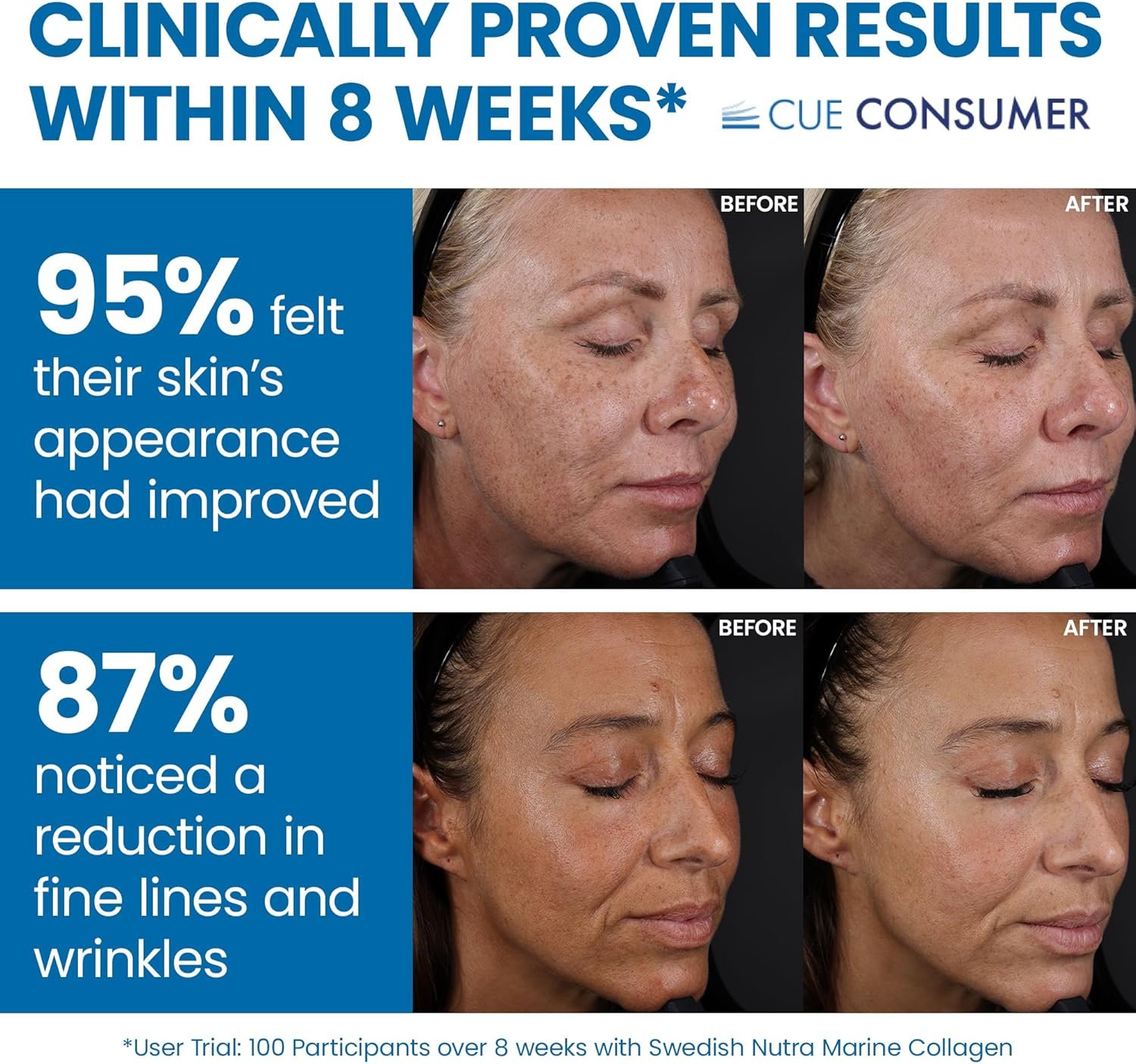 swedish nutra liquid marine collagen 10000mg swedish nutra liquid marine collagen 10000mg